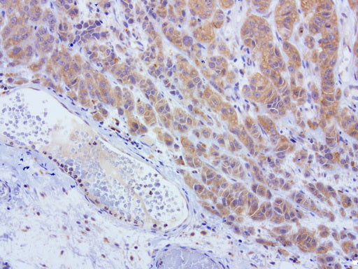 Anti-L1CAM Mouse Monoclonal Antibody