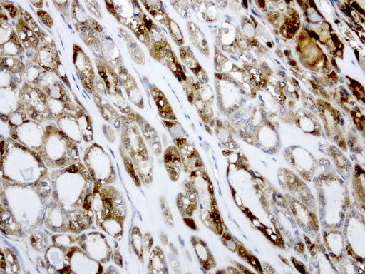 Anti-Galectin 3 Mouse Monoclonal Antibody