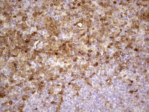 Anti-Galectin 3 Mouse Monoclonal Antibody