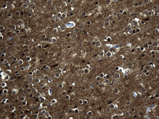 Anti-Tau Mouse Monoclonal Antibody