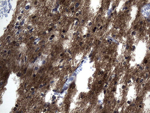 Anti-Tau Mouse Monoclonal Antibody