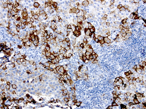 Anti-CD146  Mouse Monoclonal Antibody