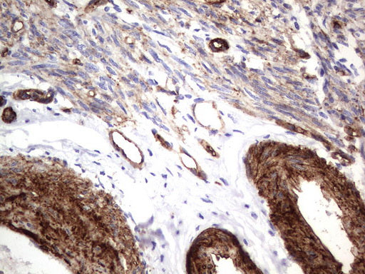 Anti-CD146  Mouse Monoclonal Antibody