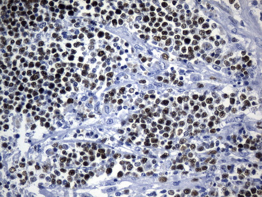 Anti-MCM2 Mouse Monoclonal Antibody