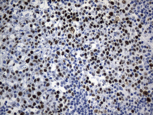 Anti-MCM2 Mouse Monoclonal Antibody