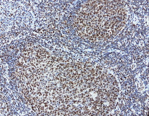 Anti-MEF2C Mouse Monoclonal Antibody