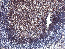 Anti-MEF2C Mouse Monoclonal Antibody