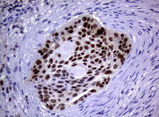 Anti-MGMT Mouse Monoclonal Antibody