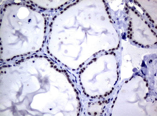 Anti-MGMT Mouse Monoclonal Antibody