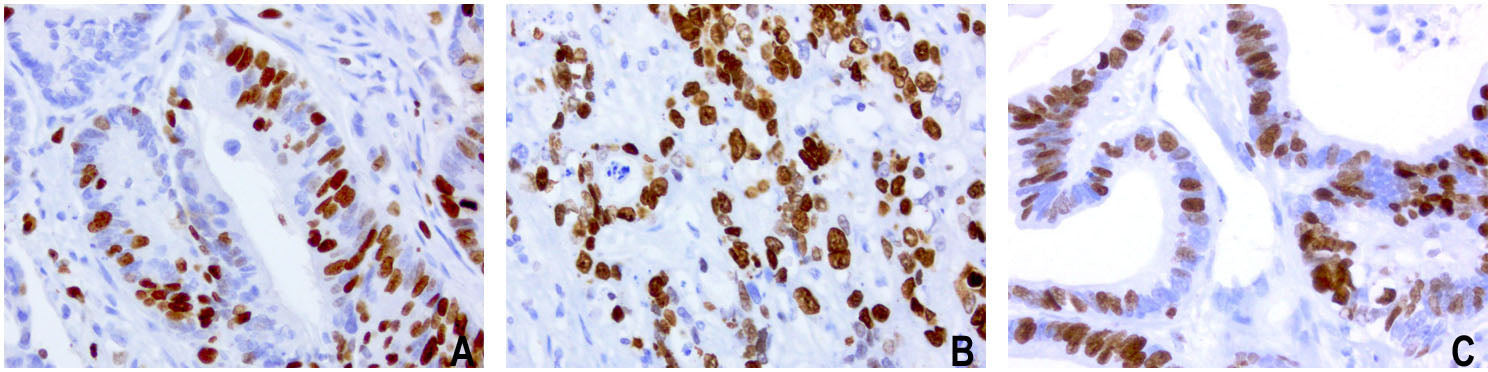 Anti-Ki67 Mouse Monoclonal Antibody