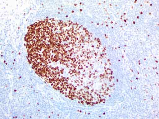 Anti-Ki67 Mouse Monoclonal Antibody