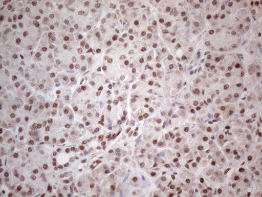 Anti-MLH1 Mouse Monoclonal Antibody