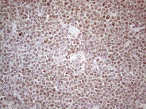 Anti-MLH1 Mouse Monoclonal Antibody