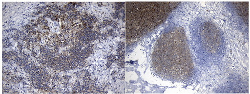 Anti-CD10 Mouse Monoclonal Antibody