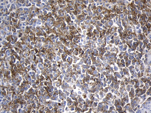 Anti-CD10 Mouse Monoclonal Antibody