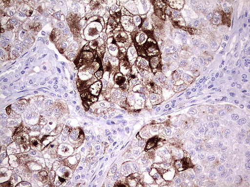 Anti-MMP7 Mouse Monoclonal Antibody