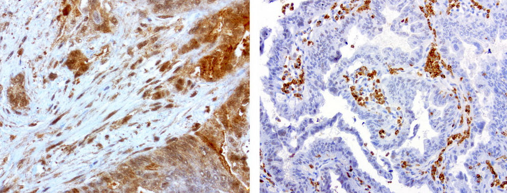 Anti-MMP7 Mouse Monoclonal Antibody
