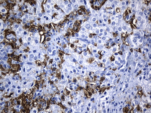 Anti-MSR1 Mouse Monoclonal Antibody