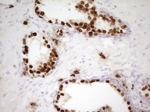 Anti-NKX3.1 Mouse Monoclonal Antibody
