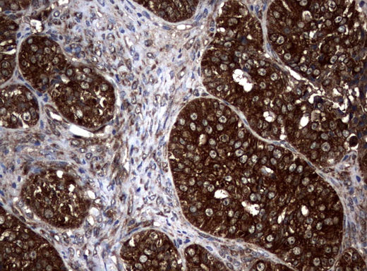 Anti-NM23A Mouse Monoclonal Antibody