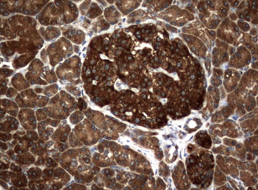 Anti-NM23A Mouse Monoclonal Antibody