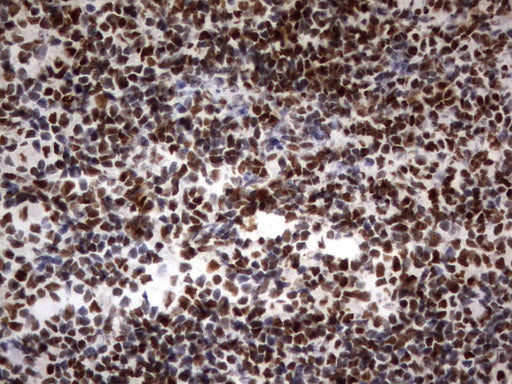 Anti-PARN Mouse Monoclonal Antibody