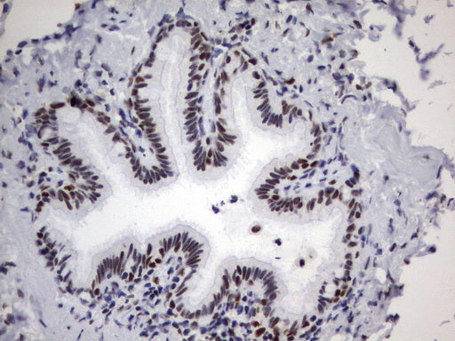 Anti-PARN Mouse Monoclonal Antibody