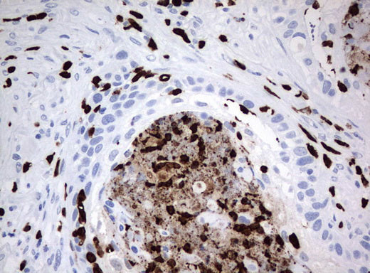 Anti-PBX1 Mouse Monoclonal Antibody