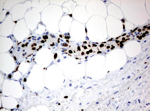 Anti-PBX1 Mouse Monoclonal Antibody
