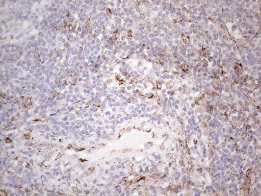 Anti-PRPH Mouse Monoclonal Antibody