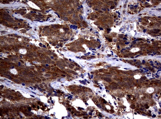 Anti-Proteasome alpha 6 Mouse Monoclonal Antibody