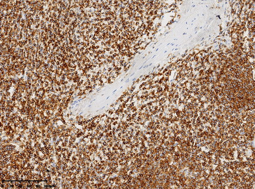 Anti-CD45 Mouse Monoclonal Antibody