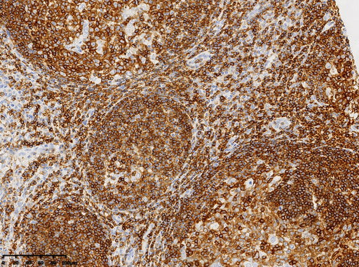 Anti-CD45 Mouse Monoclonal Antibody