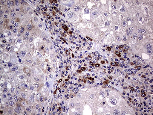 Anti-RRM1 Mouse Monoclonal Antibody