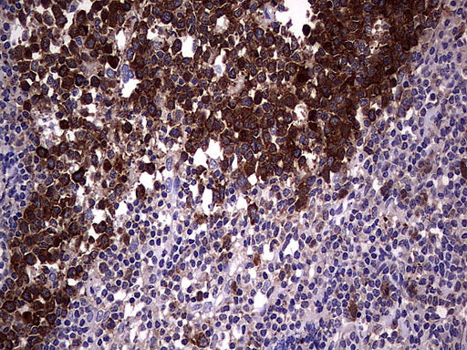Anti-RRM1 Mouse Monoclonal Antibody