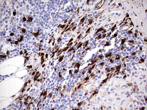 Anti-S100 alpha9 Mouse Monoclonal Antibody