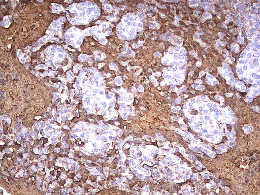 Anti-S100 alpha9 Mouse Monoclonal Antibody