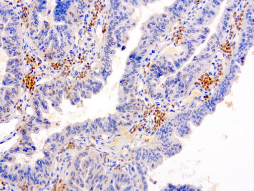 Anti-SERPINB4 Mouse Monoclonal Antibody