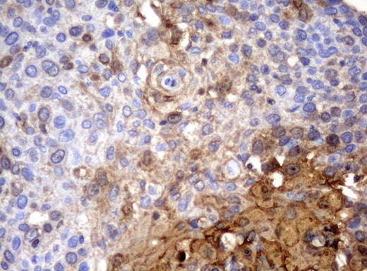 Anti-SERPINB4 Mouse Monoclonal Antibody