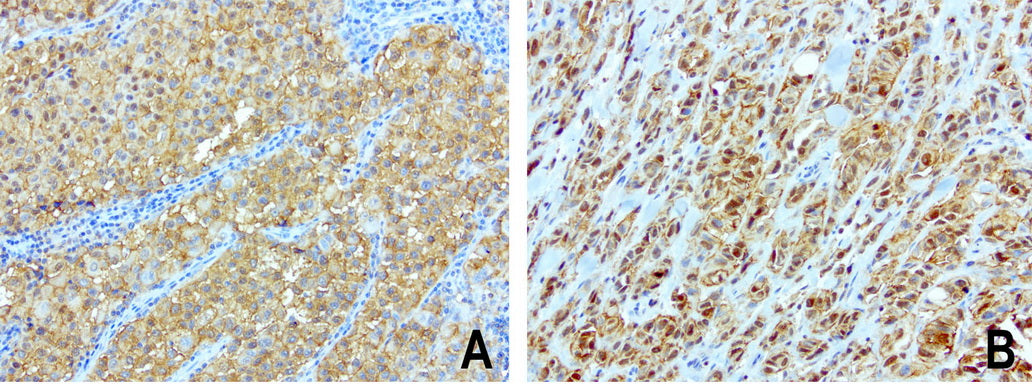 Anti-Syntenin 1 Mouse Monoclonal Antibody