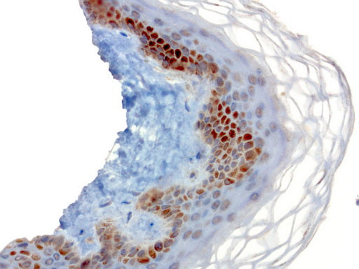 Anti-SOX5 Mouse Monoclonal Antibody