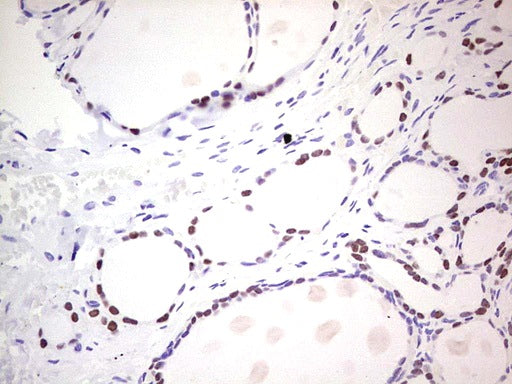 Anti-Thyroid Transcription Factor 1 Mouse Monoclonal Antibody