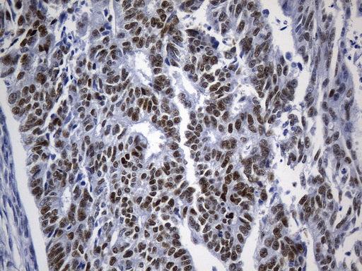 Anti-TLE1 Mouse Monoclonal Antibody