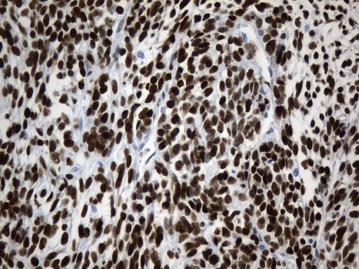 Anti-TLE1 Mouse Monoclonal Antibody