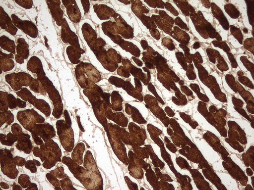 Anti-Cardiac Troponin C Mouse Monoclonal Antibody