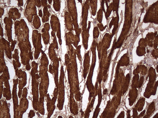 Anti-Cardiac Troponin T Mouse Monoclonal Antibody