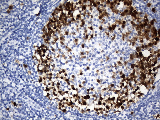 Anti-Thymidylate Synthase Mouse Monoclonal Antibody