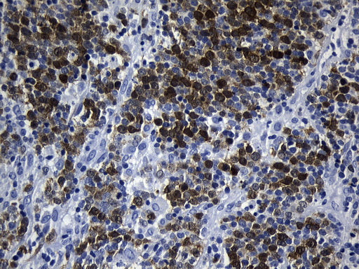 Anti-Thymidylate Synthase Mouse Monoclonal Antibody
