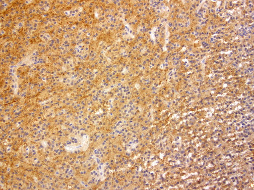 Anti-VILIP Mouse Monoclonal Antibody