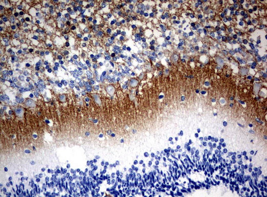 Anti-VILIP Mouse Monoclonal Antibody
